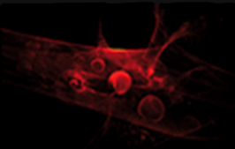 インディバ・アクティブ:微小循環 / 温熱(血管新生)