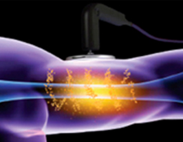 プロイオニック・ システム